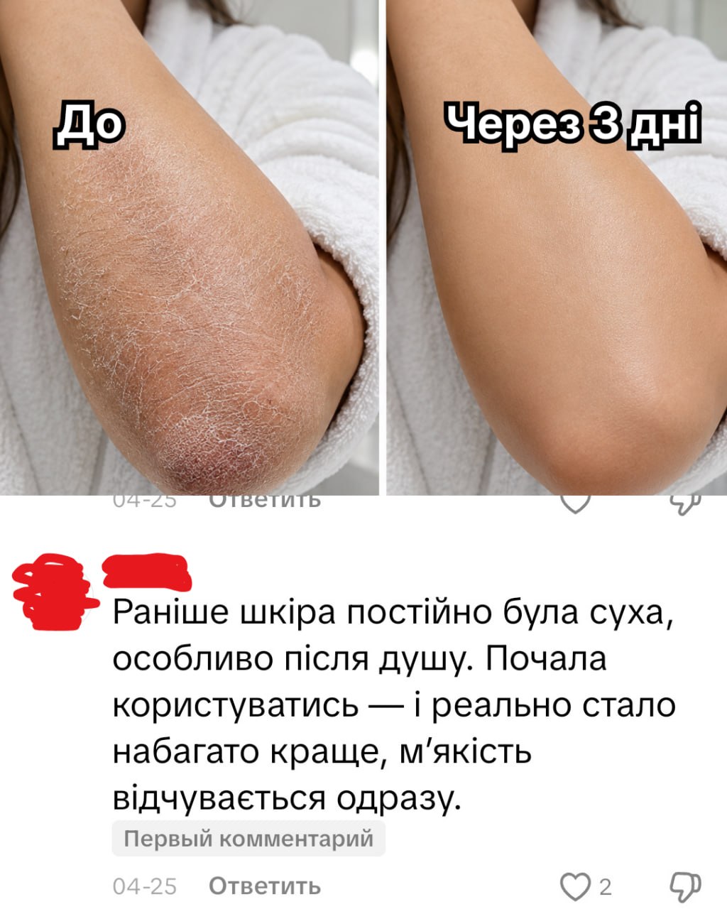 Відгук покупця ALVEA — руки до/після