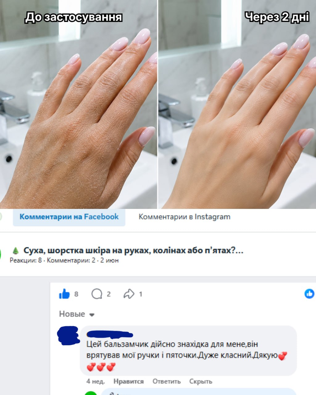Відгук покупця ALVEA — відновлення шкіри рук